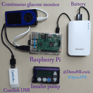 what-an-openaps-looks-like-by-danamlewis